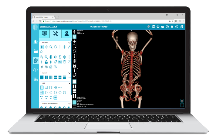 download dicom viewer for mac free